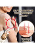 Vitiligo Removal Cream Ointment 20g, Skin Vitiligo Treatment for Skin Vitiligo كريم ازالة البهاق