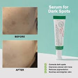 AXIS-Y Dark Spot Correcting Glow Serum with 5% Niacinamide & Rice Bran | Brightening & Moisturizing Face Serum for Uneven Skin Tone | Vegan & Cruelty-Free Korean Skin Care | 50ml / 1.69 fl. oz